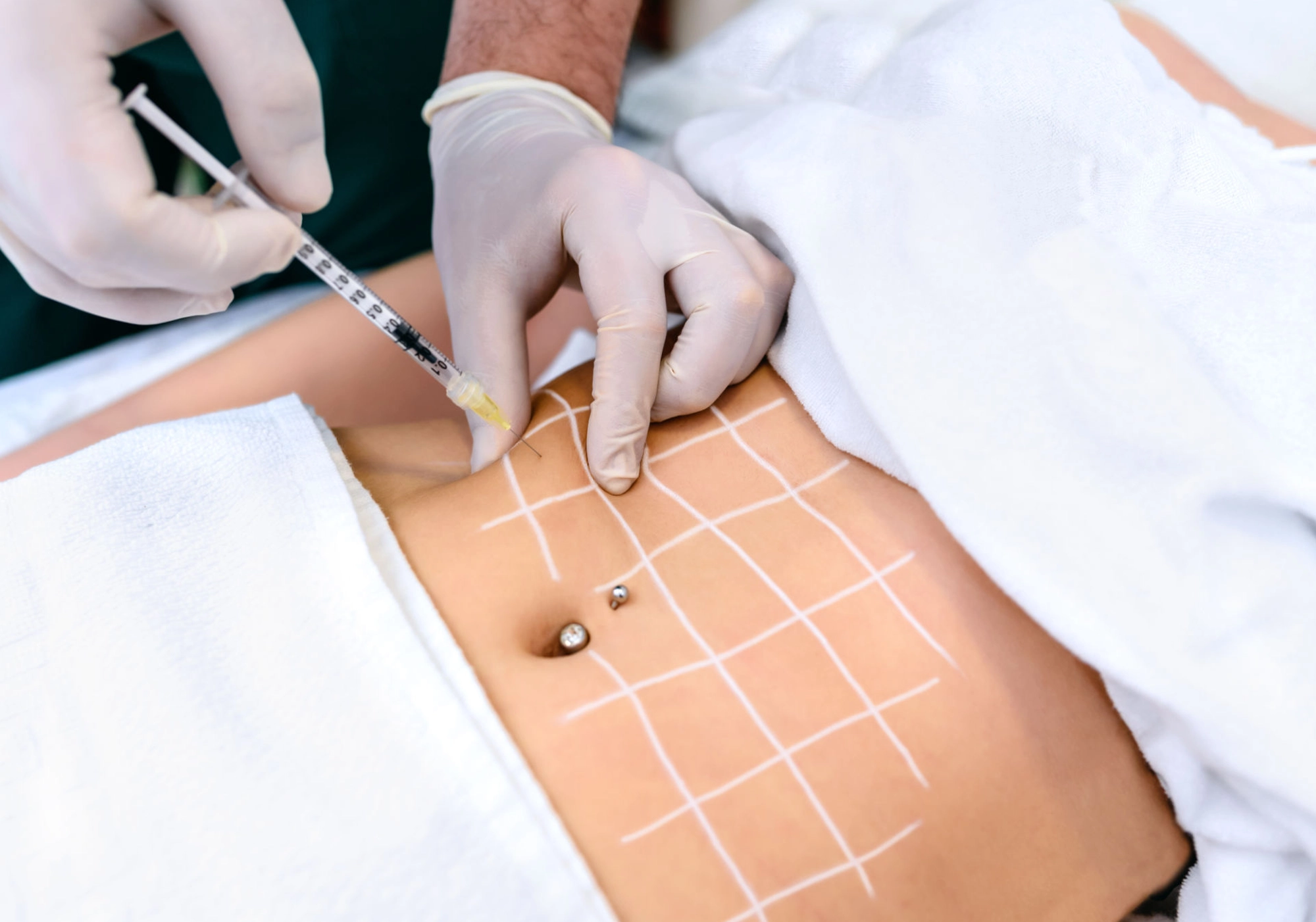 Best Body Contouring Treatment Deoxycholic Acid for Fat Reduction in Navi Mumbai