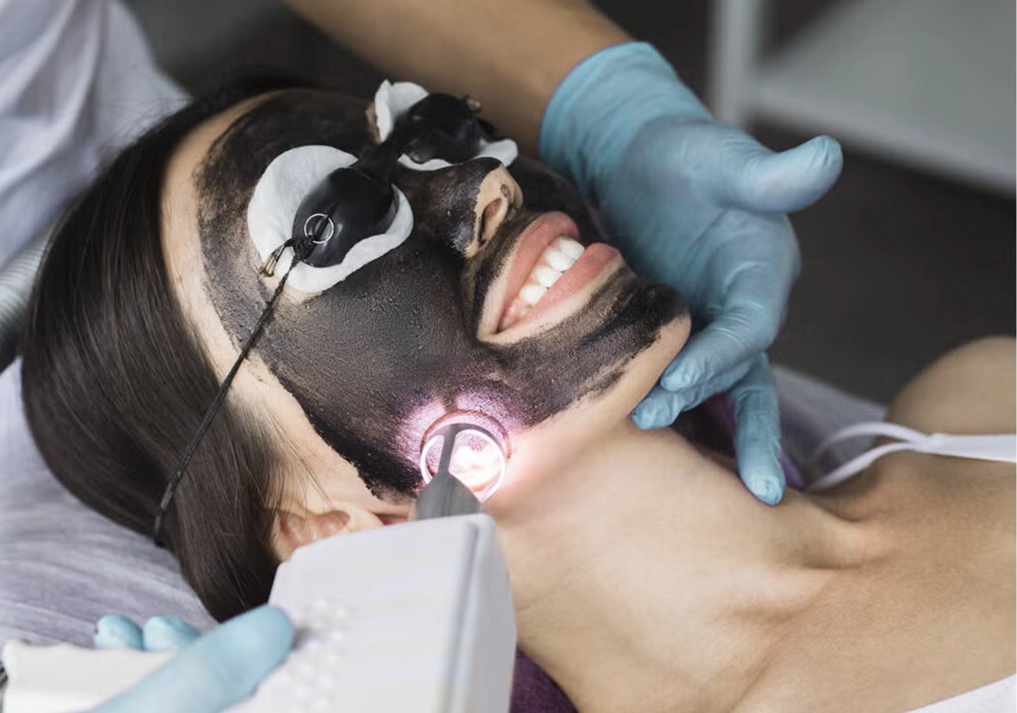Best Skin Treatment Carbon Laser in Navi Mumbai