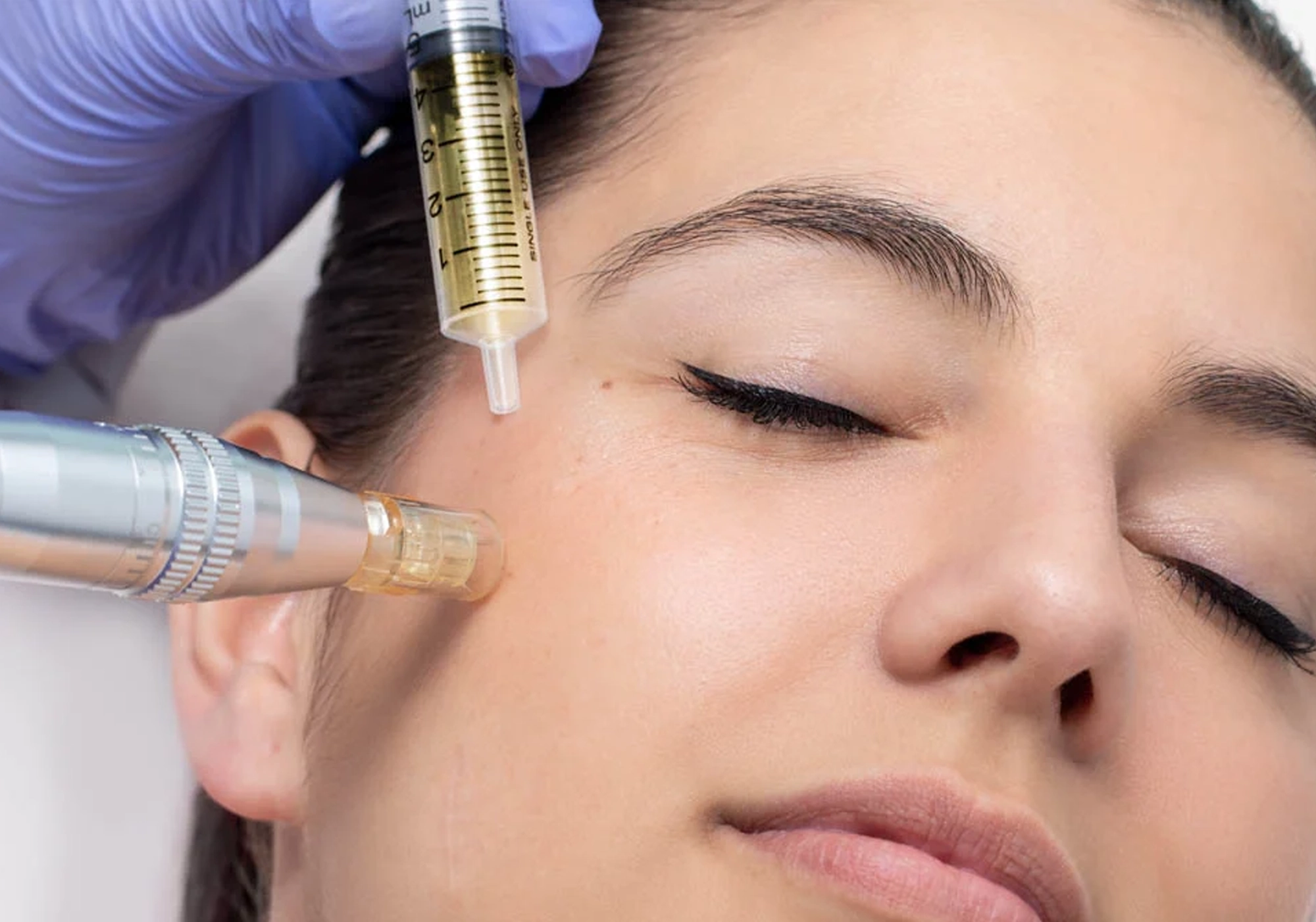 Best Skin Treatment Mesotherapy in Navi Mumbai