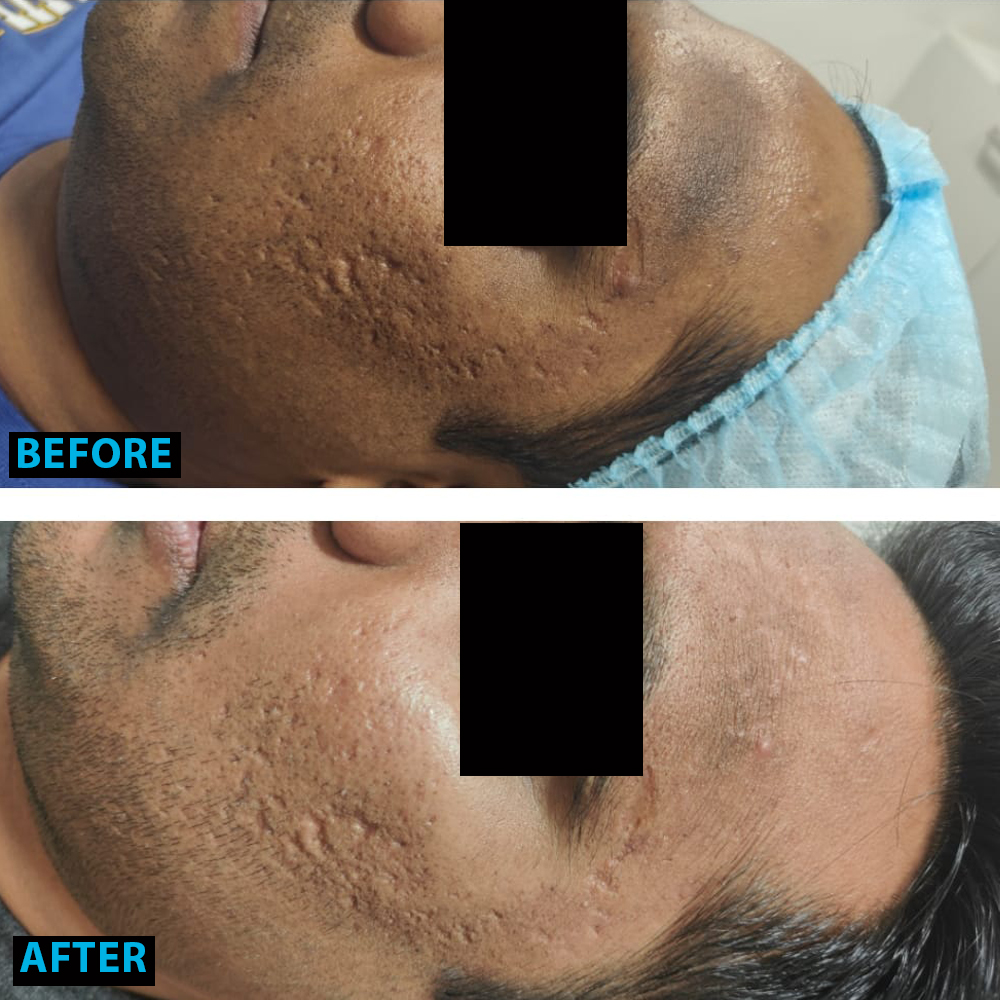 Pigmentation Reduction Skin Lightening 2