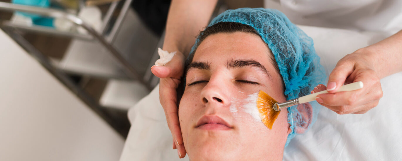 Why are chemical peels the secret to clear and smooth skin