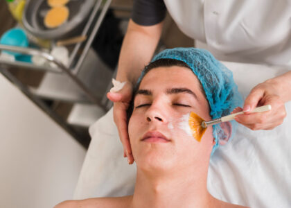 Why are chemical peels the secret to clear and smooth skin