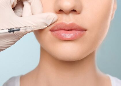 Fillers 101 Restore Volume and Balance Your Facial Features Naturally