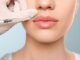 Fillers 101 Restore Volume and Balance Your Facial Features Naturally