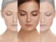 Combining PRP with Laser The Ultimate Skin Rejuvenation Duo